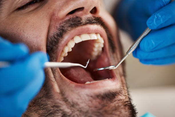 Best Emergency Treatment for Oral Infections in Morgan Hill, PA