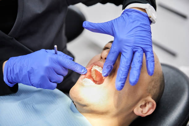 Best Emergency Root Canal Therapy in Morgan Hill, PA